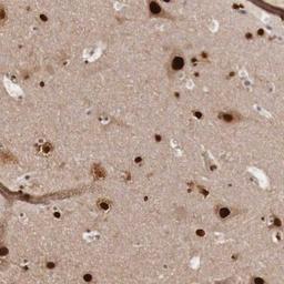 Immunohistochemistry: KHDRBS3 Antibody [NBP1-84774] - Staining of human cerebral cortex shows strong nuclear positivity in neuronal cells.