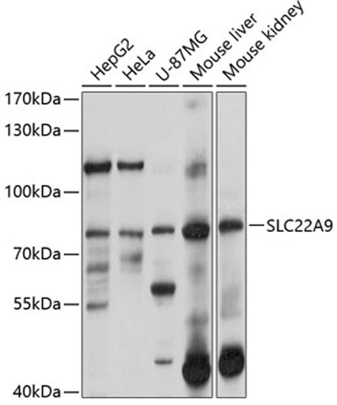 Western blot - SLC22A9 antibody (A10434)