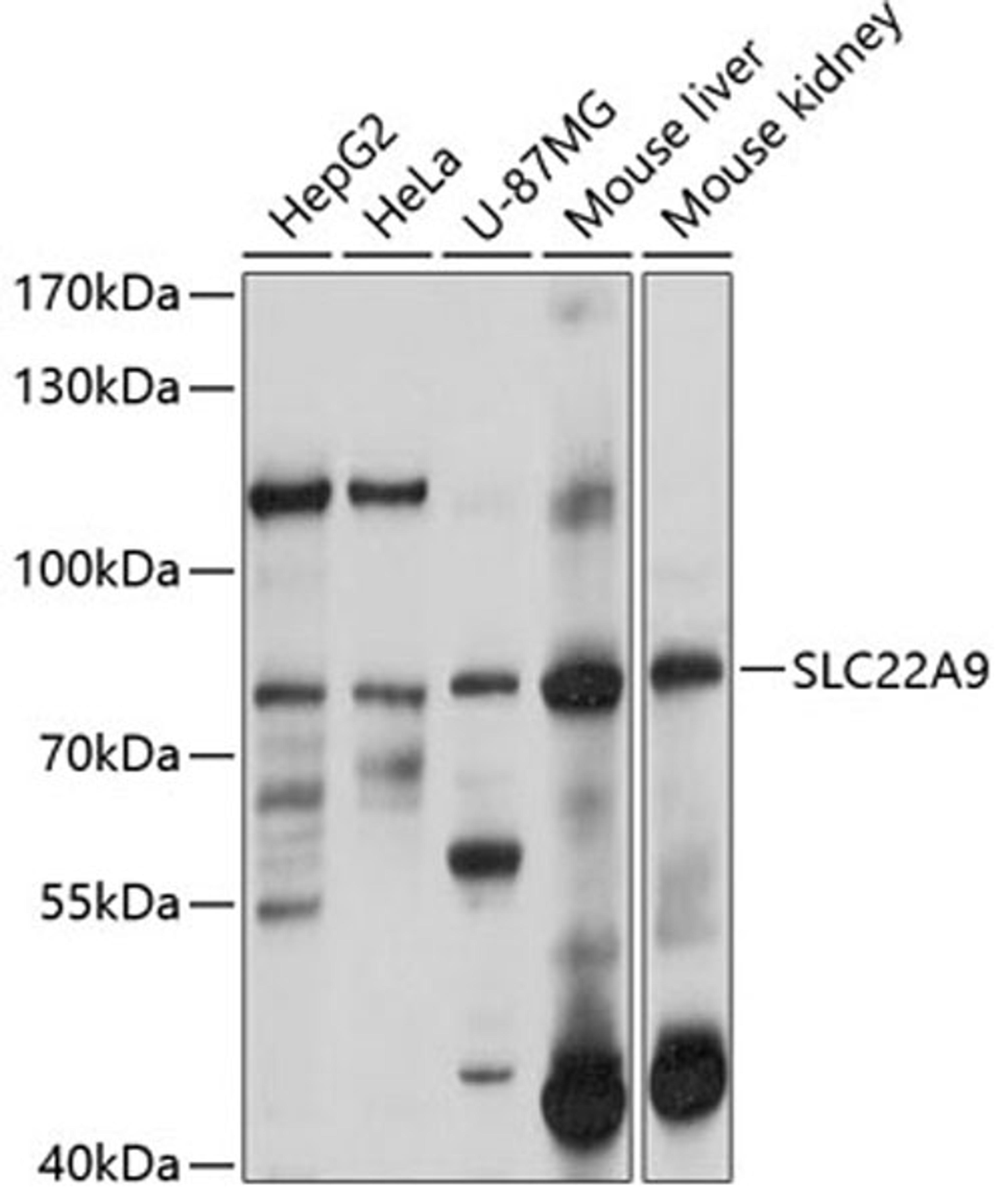 Western blot - SLC22A9 antibody (A10434)