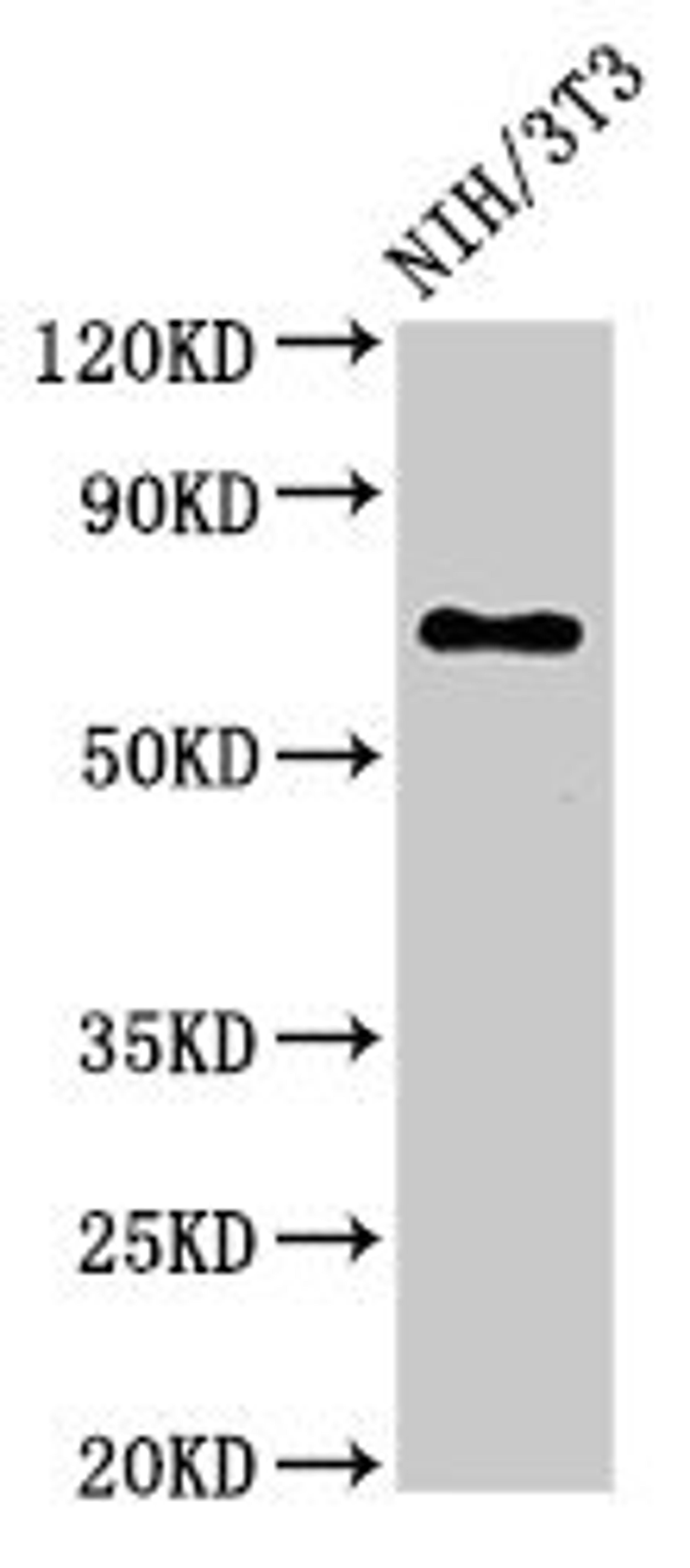 Western Blot. Positive WB detected in: NIH/3T3 whole cell lysate. All lanes: ZMYND11 antibody at 3ug/ml. Secondary. Goat polyclonal to rabbit IgG at 1/50000 dilution. Predicted band size: 71, 65, 67, 61 kDa. Observed band size: 71 kDa.