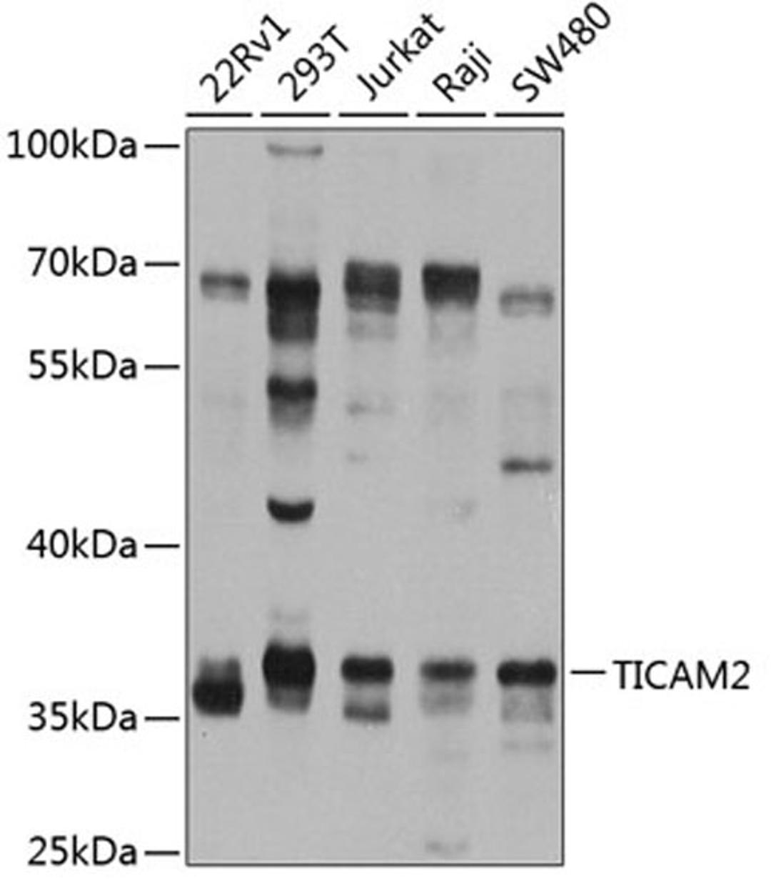 Western blot - TICAM2 antibody (A8292)