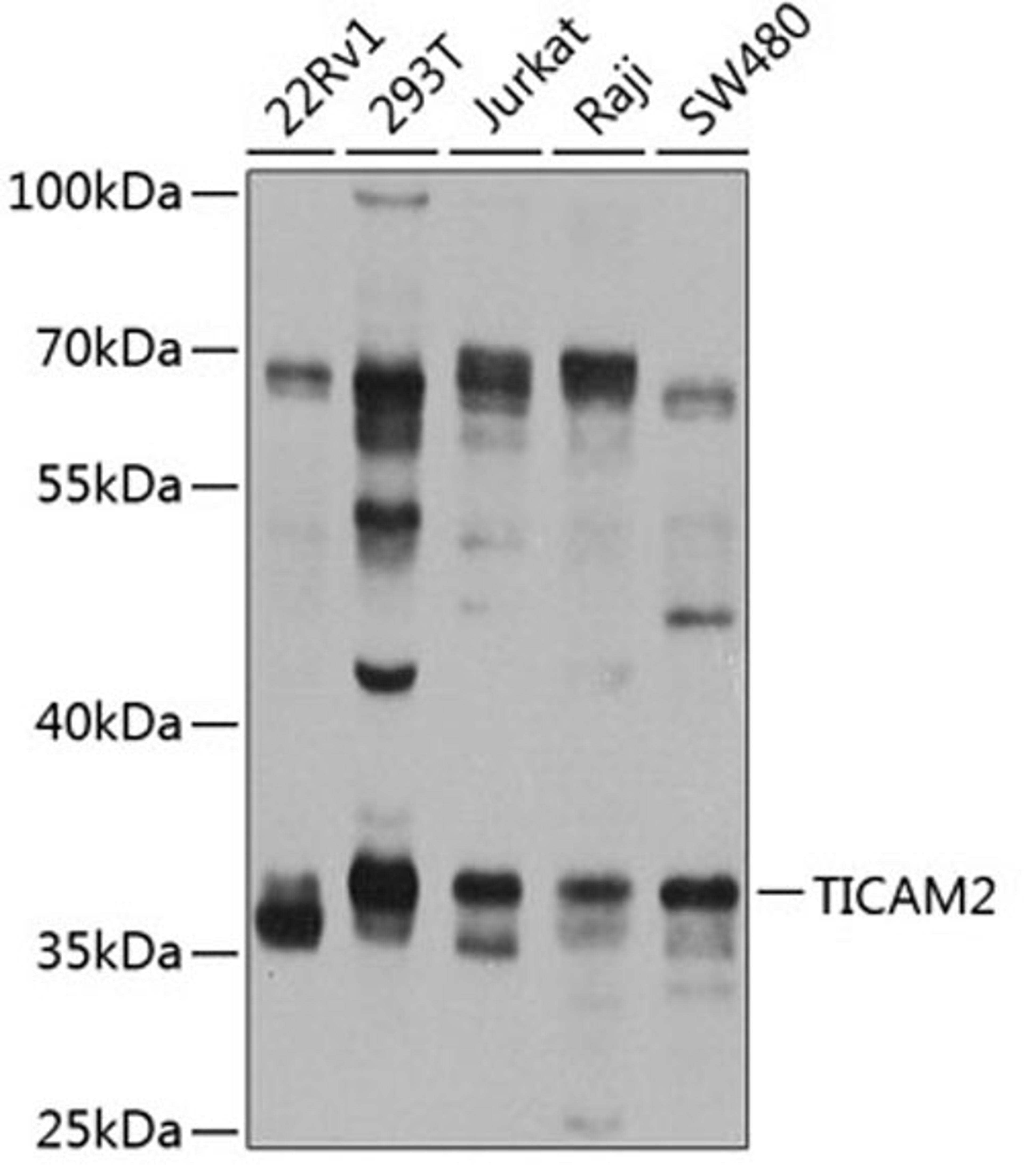 Western blot - TICAM2 antibody (A8292)