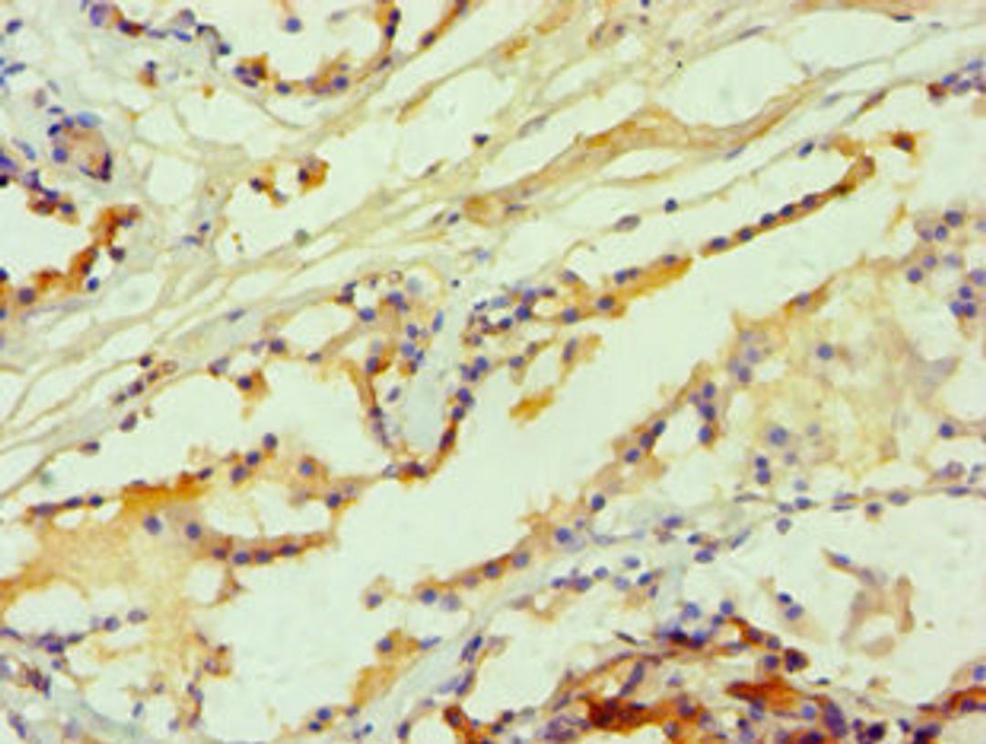Immunohistochemistry of paraffin-embedded human prostate tissue using CSB-PA010888ESR1HU at dilution of 1:100