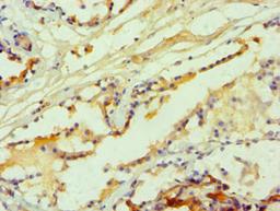 Immunohistochemistry of paraffin-embedded human prostate tissue using CSB-PA010888ESR1HU at dilution of 1:100