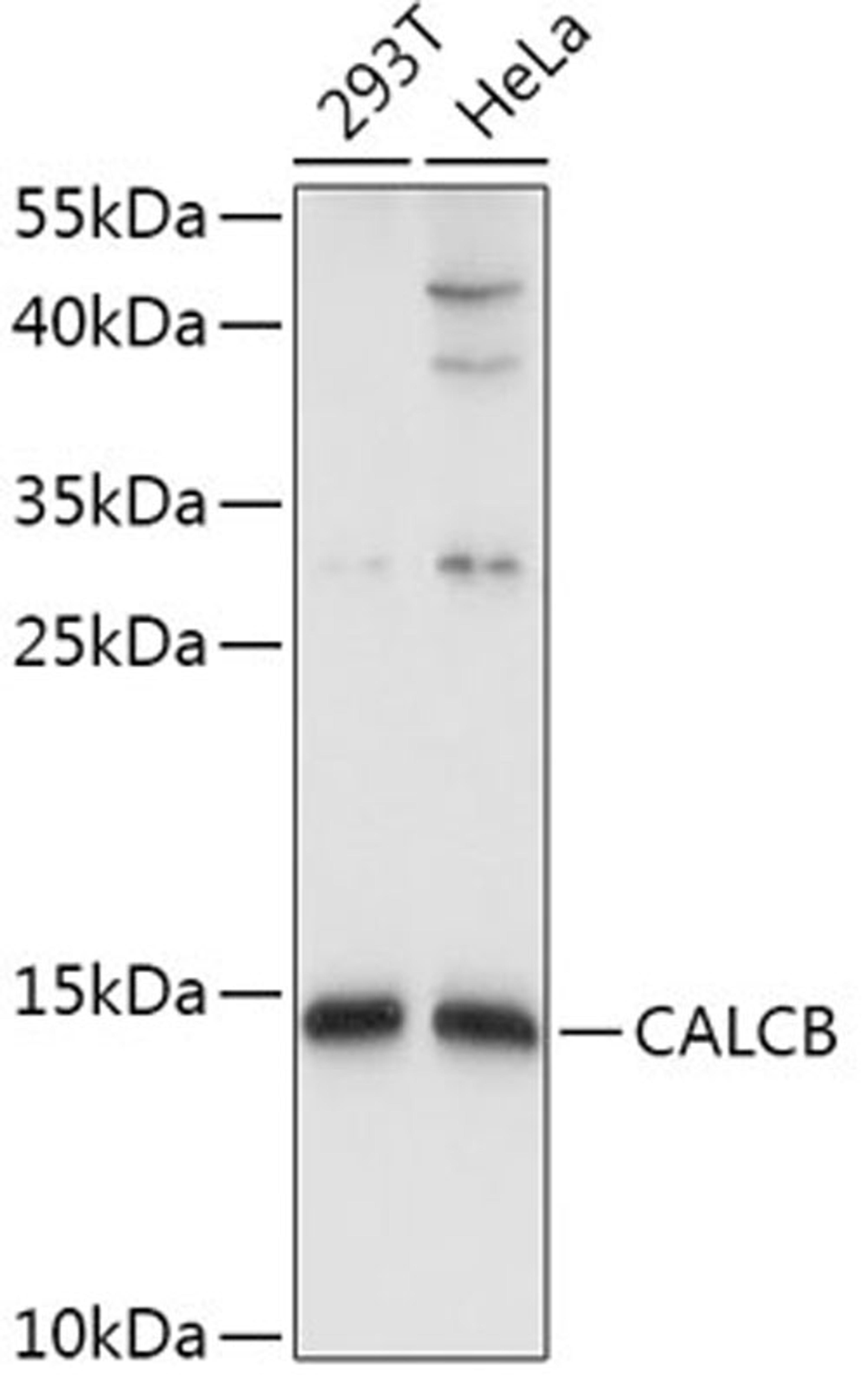 Western blot - CALCB antibody (A8105)