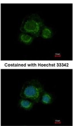 Immunocytochemistry/Immunofluorescence: CHST7 Antibody [NBP2-15897] - Analysis of methanol-fixed MCF-7, using antibody at 1:500 dilution.