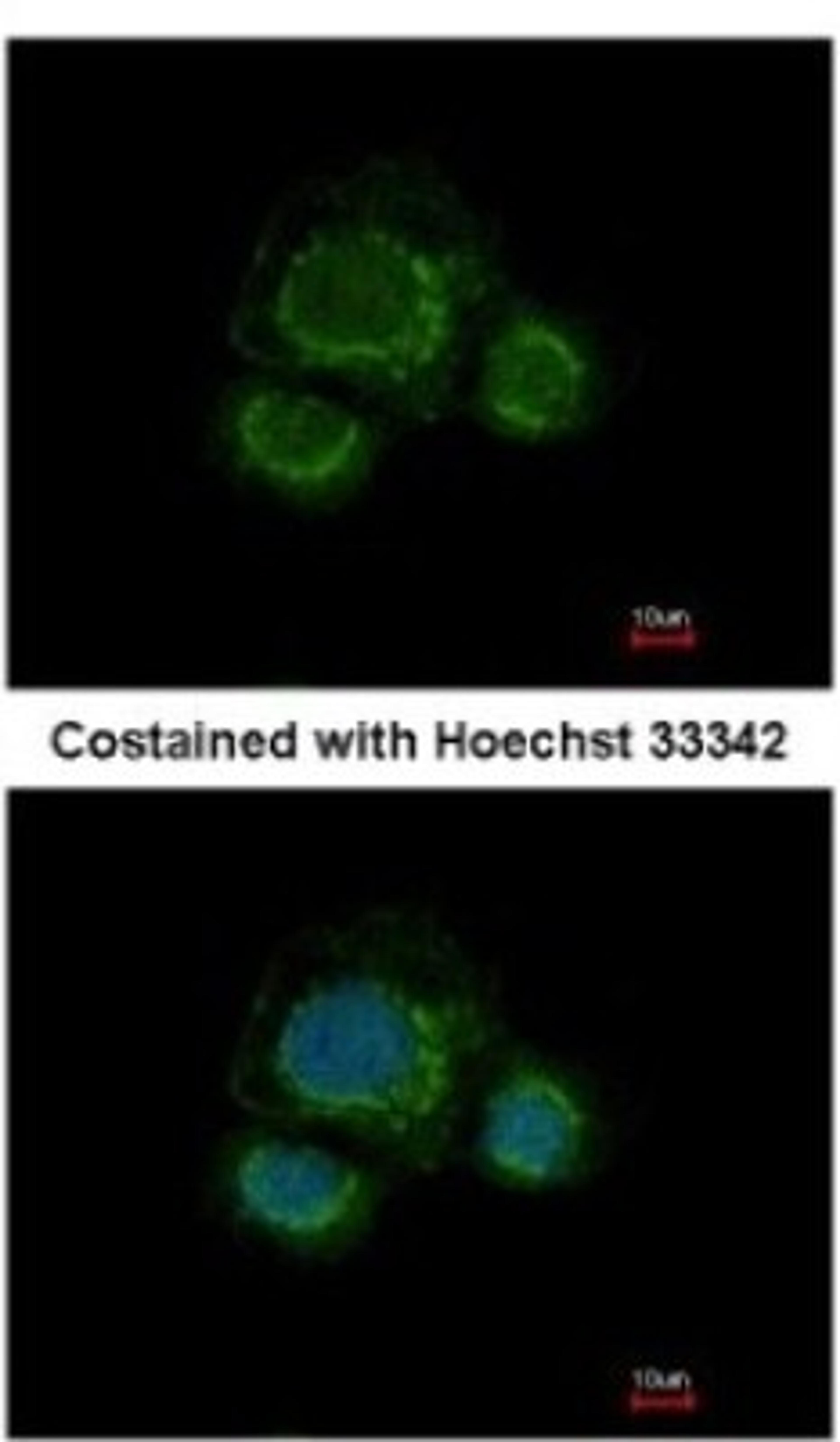 Immunocytochemistry/Immunofluorescence: CHST7 Antibody [NBP2-15897] - Analysis of methanol-fixed MCF-7, using antibody at 1:500 dilution.