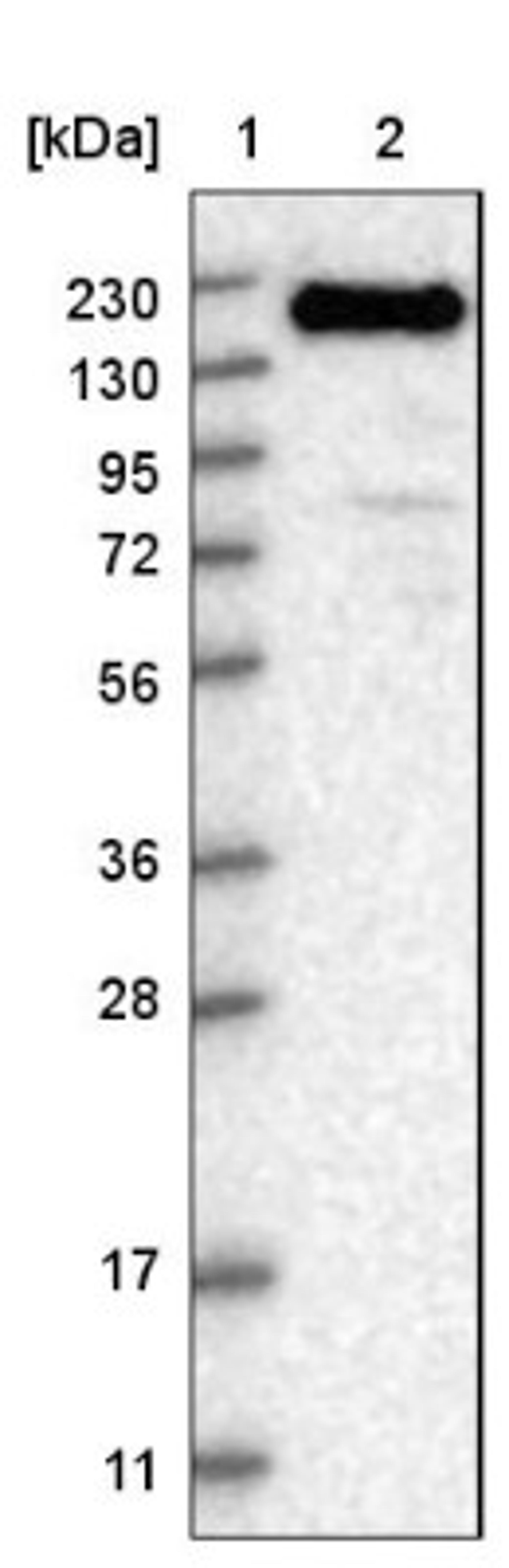 Western Blot: SFRS15 Antibody [NBP1-88004] - Lane 1: Marker [kDa] 230, 130, 95, 72, 56, 36, 28, 17, 11<br/>Lane 2: Human cell line RT-4