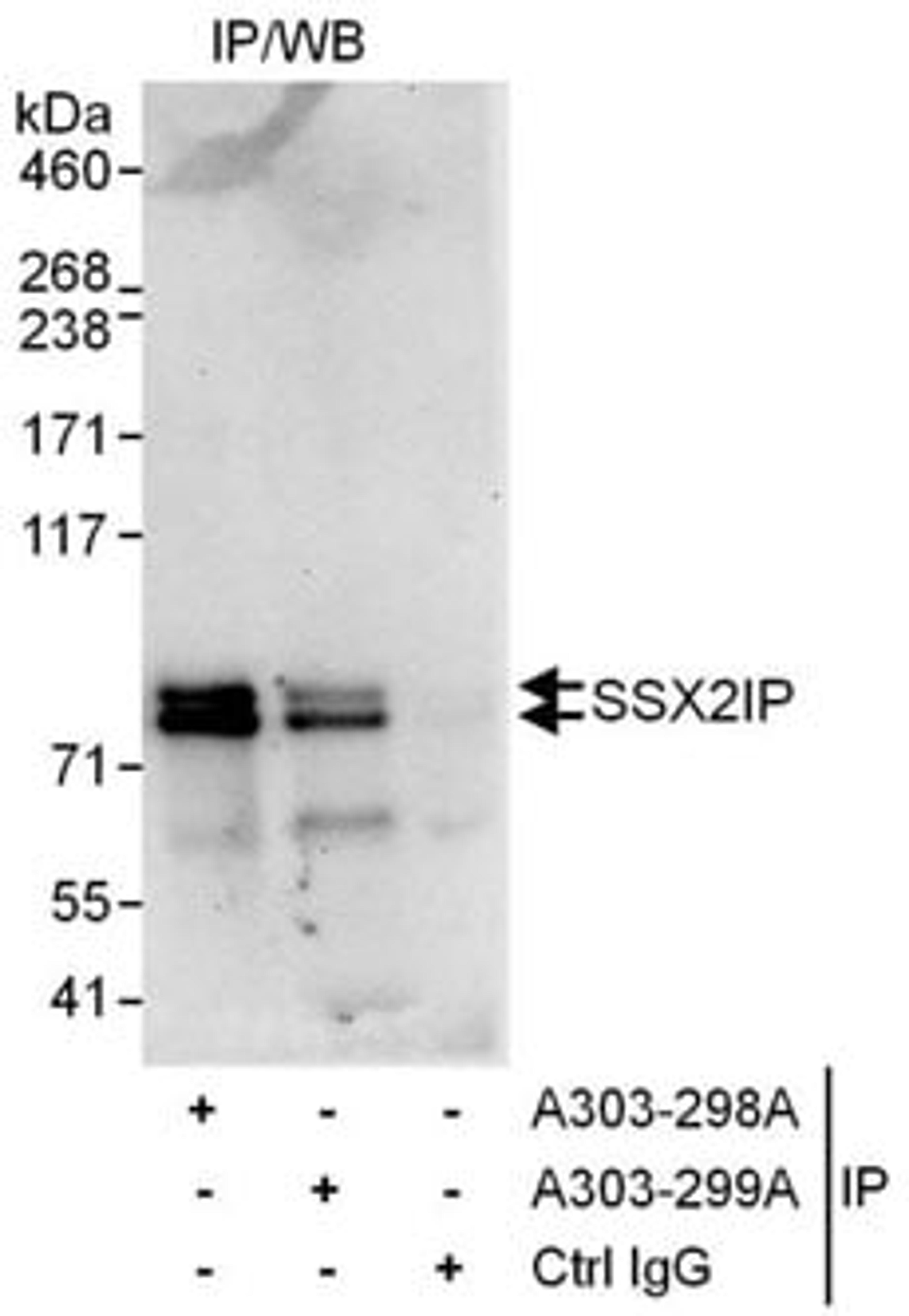 Detection of human SSX2IP by western blot of immunoprecipitates.