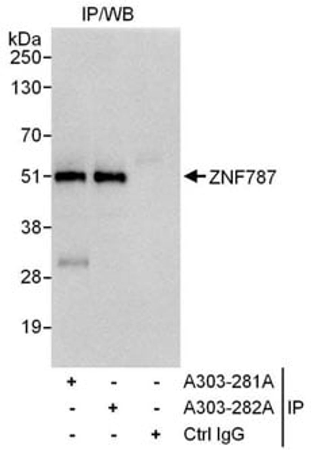 Detection of human by ZNF787 western blot of immunoprecipitates.