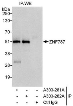 Detection of human by ZNF787 western blot of immunoprecipitates.