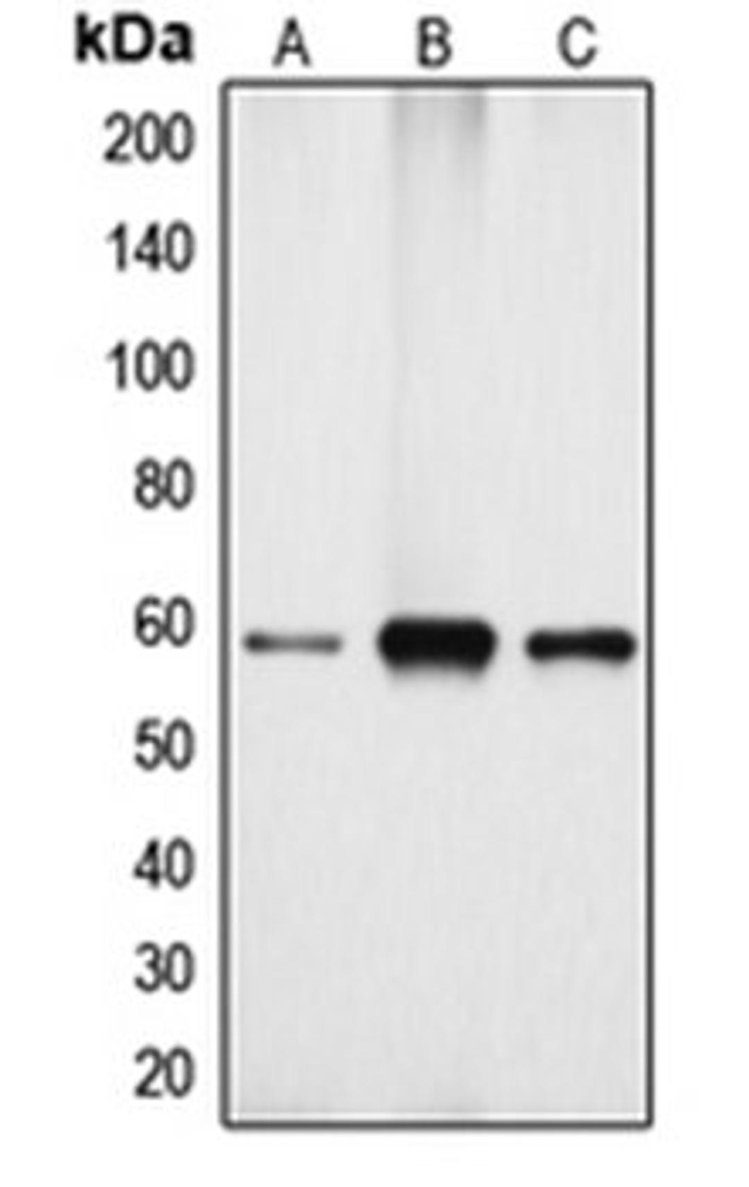 Western blot analysis of Jurkat (Lane 1), mouse kidney (Lane 2), rat kidney (Lane 3) whole cell lysates using CYP4X1 antibody