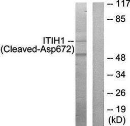 Western blot analysis of extracts from Jurkat cells using ITIH1 (Cleaved-Asp672) antibody