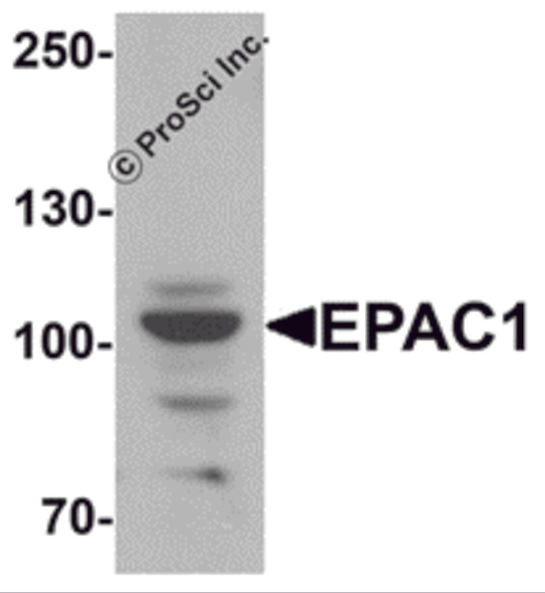 Western blot analysis of EPAC1 in rat skeletal muscle tissue lysate with EPAC1 antibody at 1 μg/mL.