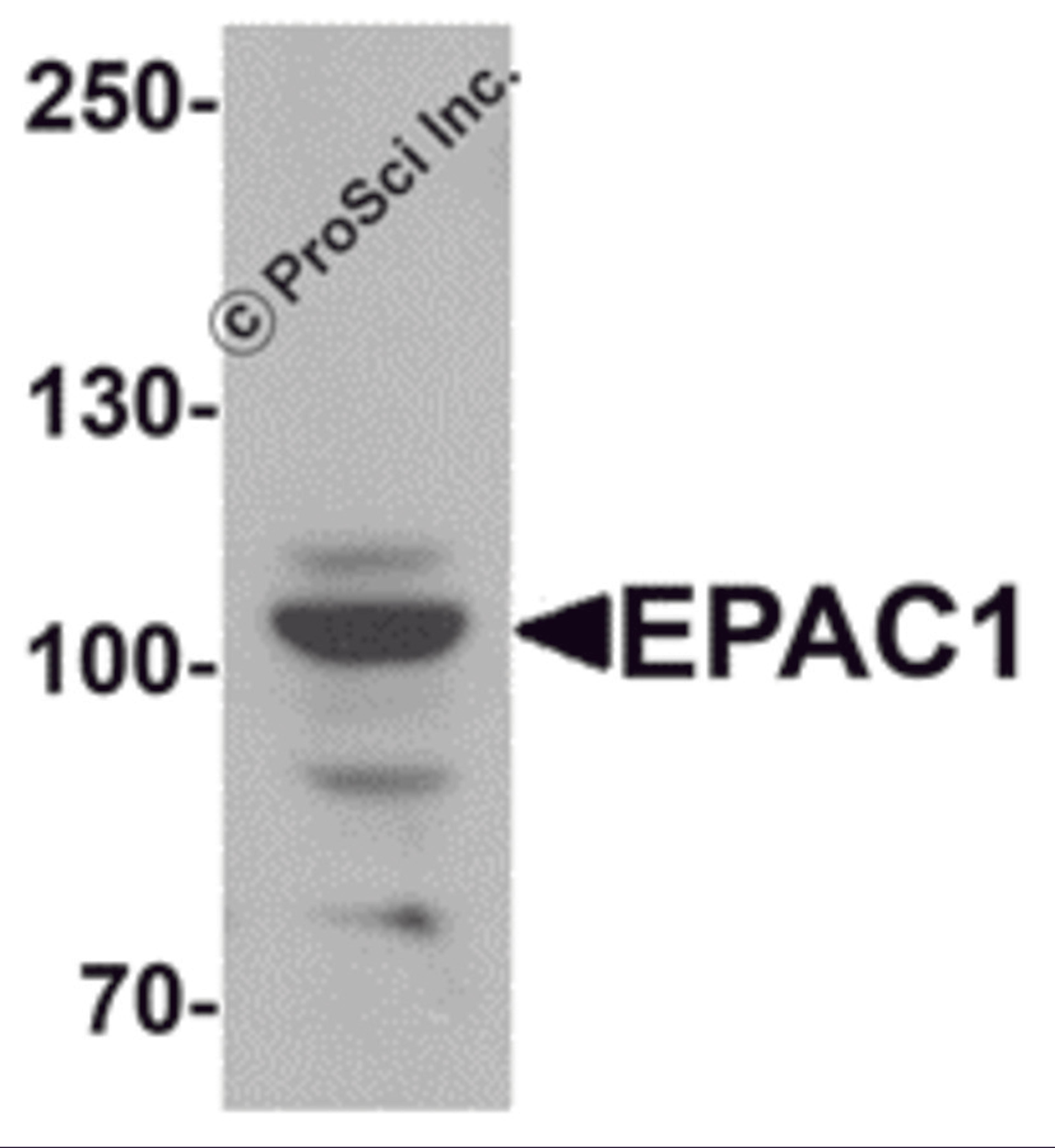 Western blot analysis of EPAC1 in rat skeletal muscle tissue lysate with EPAC1 antibody at 1 μg/mL.