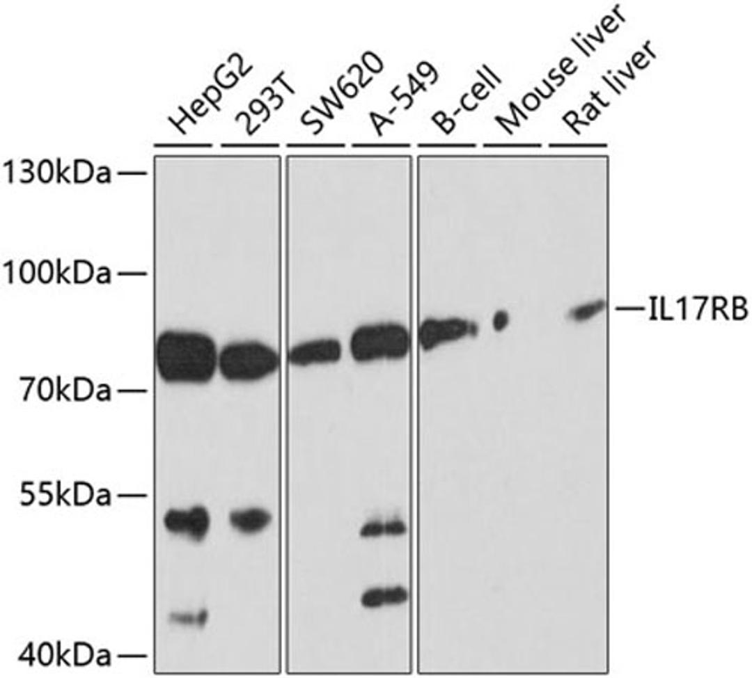 Western blot - IL17RB antibody (A10147)