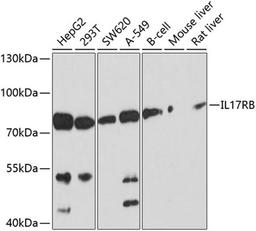 Western blot - IL17RB antibody (A10147)