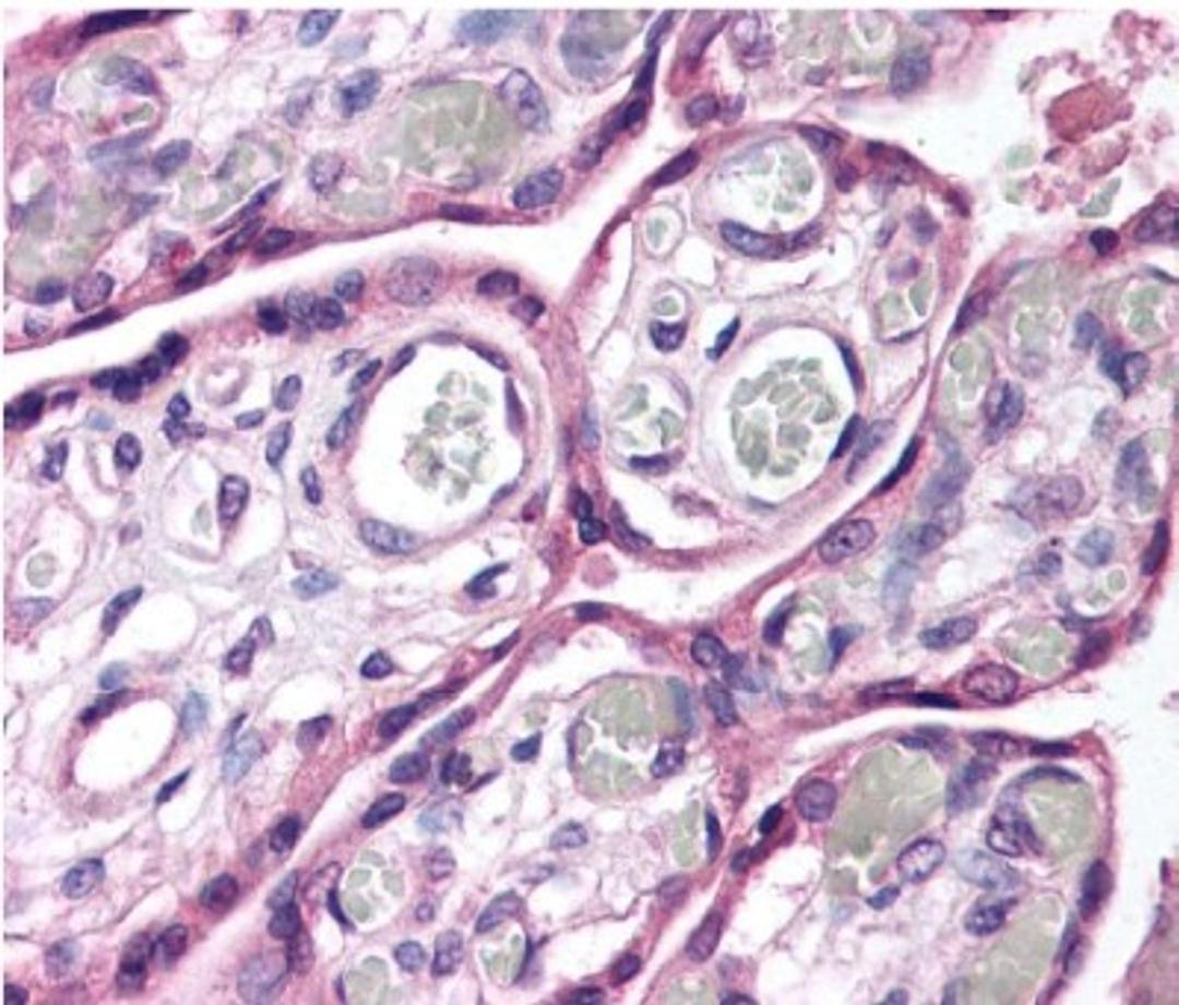 Immunohistochemistry: Robo4 Antibody [NB110-58780] - Detection of ROBO4 in human placental epithelial cells and trophoblasts.