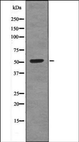 Western blot analysis of EGF treated NIH-3T3 whole cell lysates using CEP55 -Phospho-Ser425- antibody