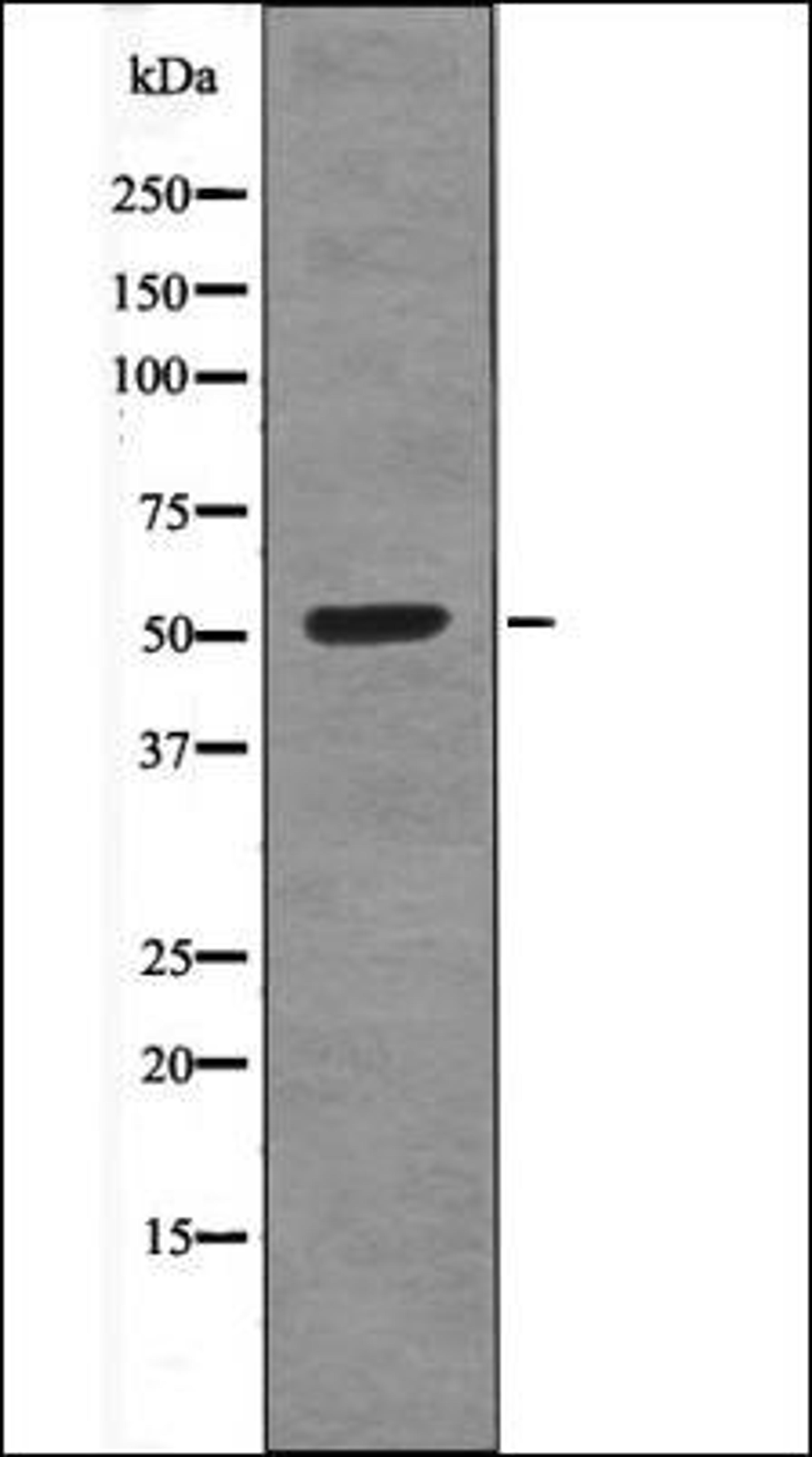 Western blot analysis of EGF treated NIH-3T3 whole cell lysates using CEP55 -Phospho-Ser425- antibody