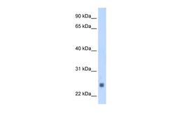 Antibody used in WB on Human Muscle at 1.25 ug/ml.