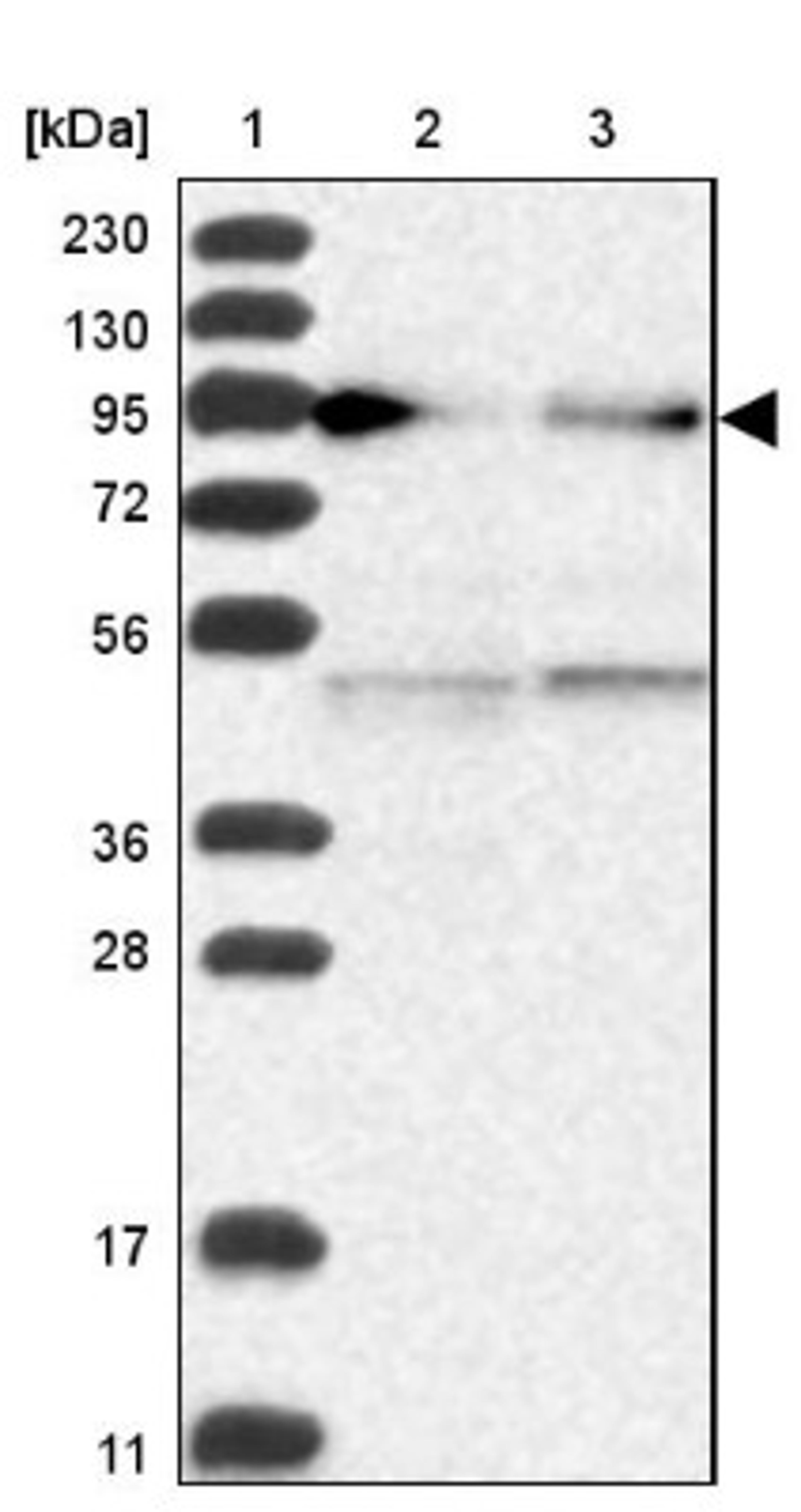 Western Blot: Epac2 Antibody [NBP2-32009] - Lane 1: Marker [kDa] 230, 130, 95, 72, 56, 36, 28, 17, 11<br/>Lane 2: Human cell line RT-4<br/>Lane 3: Human cell line U-251MG sp