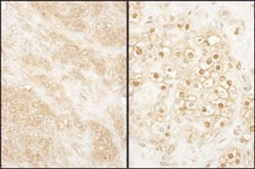 Detection of human PCTAIRE 2 by immunohistochemistry.