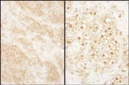 Detection of human PCTAIRE 2 by immunohistochemistry.