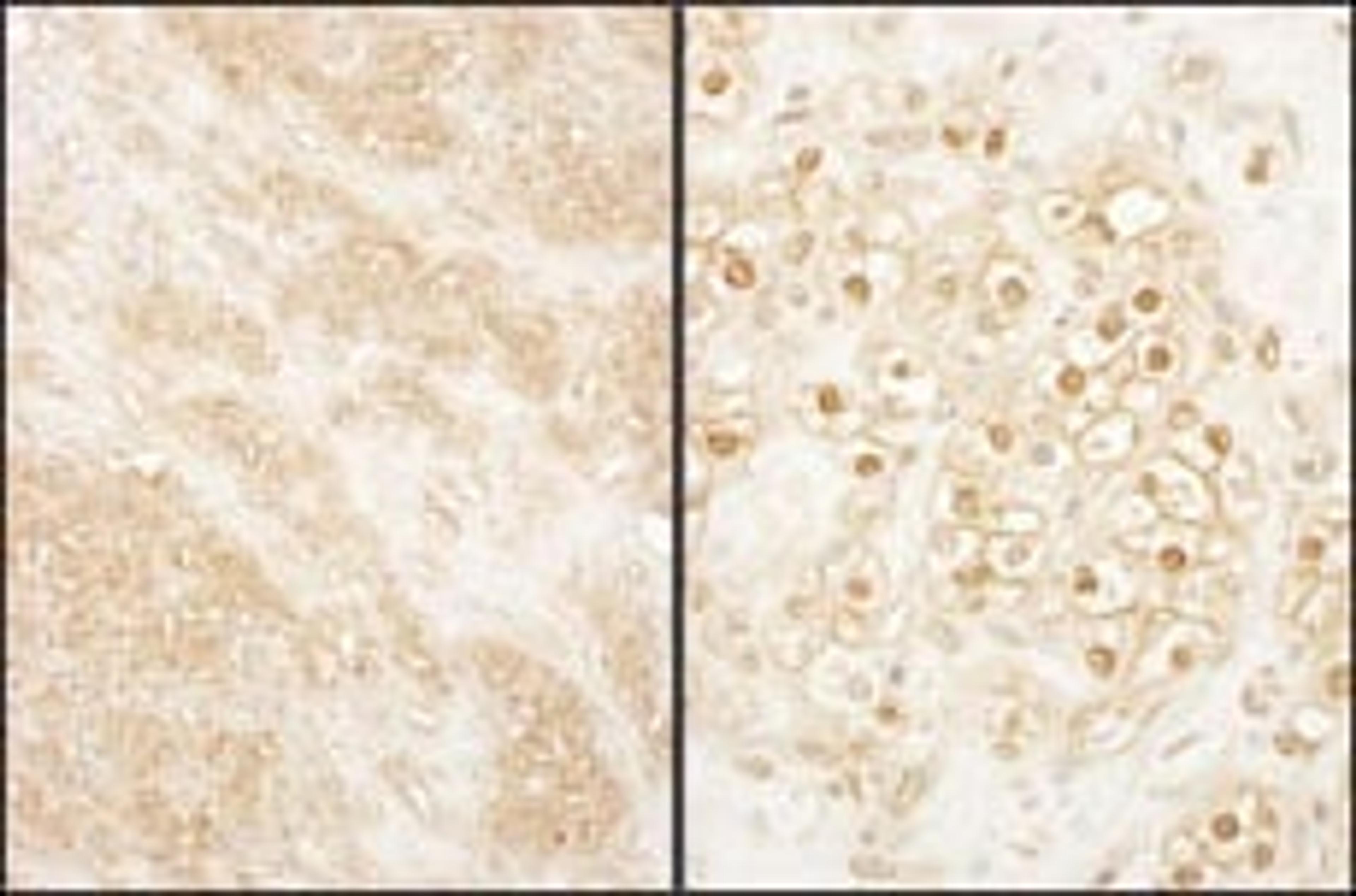 Detection of human PCTAIRE 2 by immunohistochemistry.