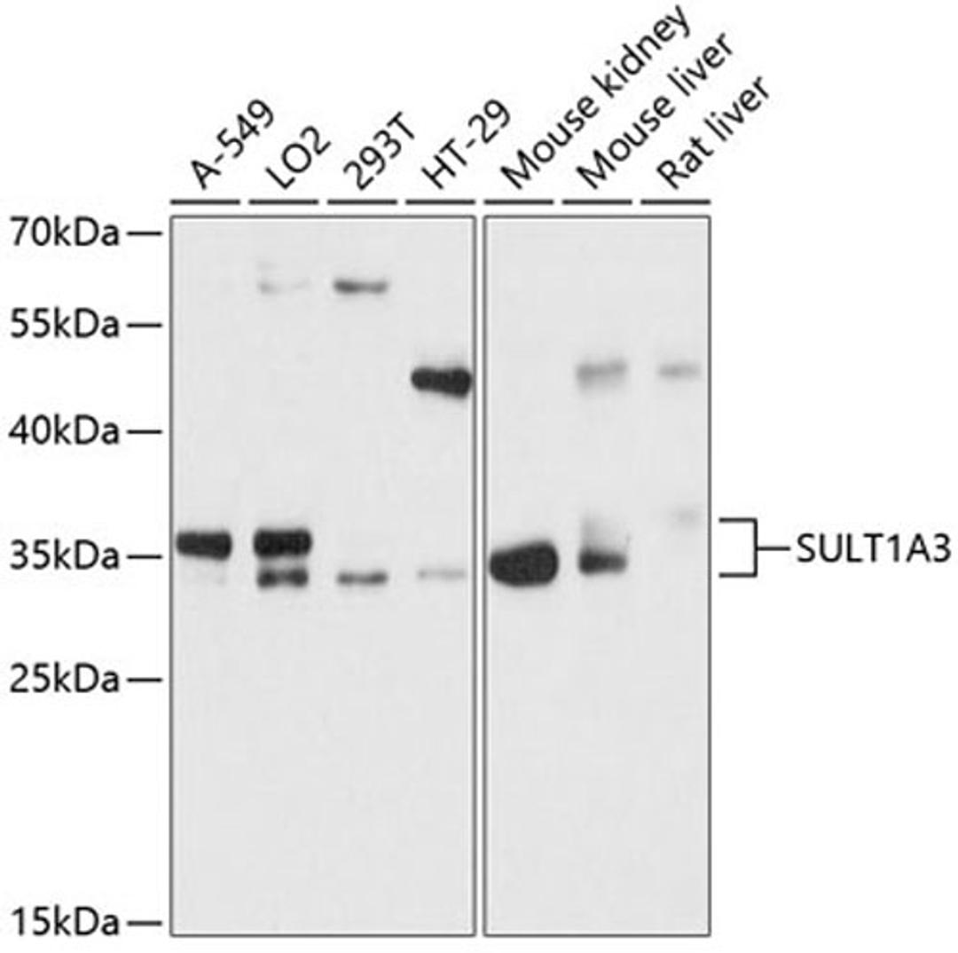 Western blot - SULT1A3 antibody (A12357)