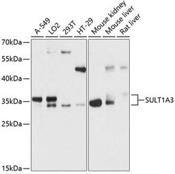 Western blot - SULT1A3 antibody (A12357)