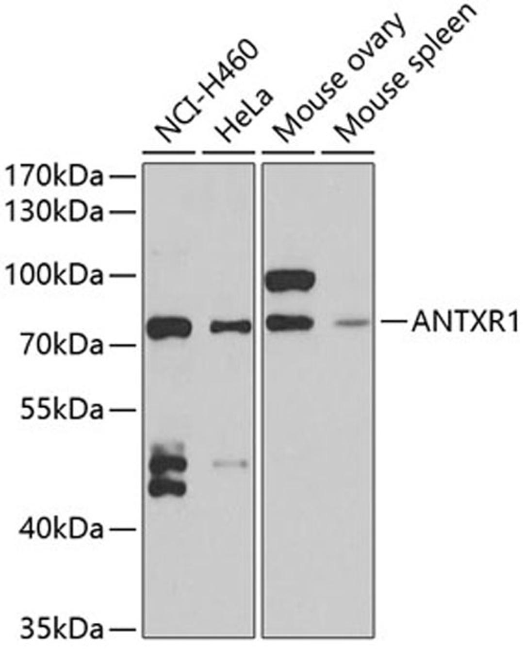 Western blot - ANTXR1 antibody (A6525)