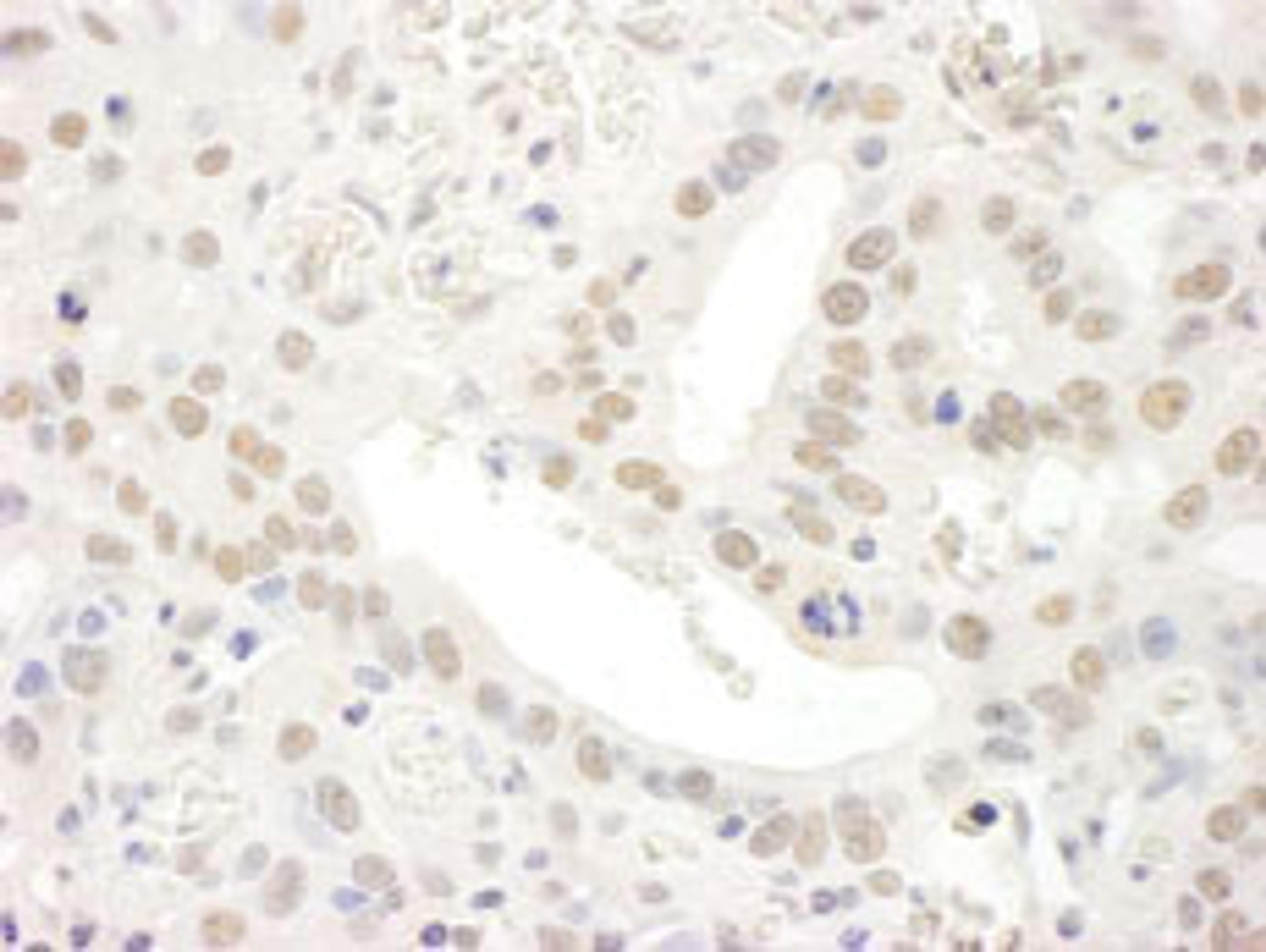 Detection of human TFIIS by immunohistochemistry.