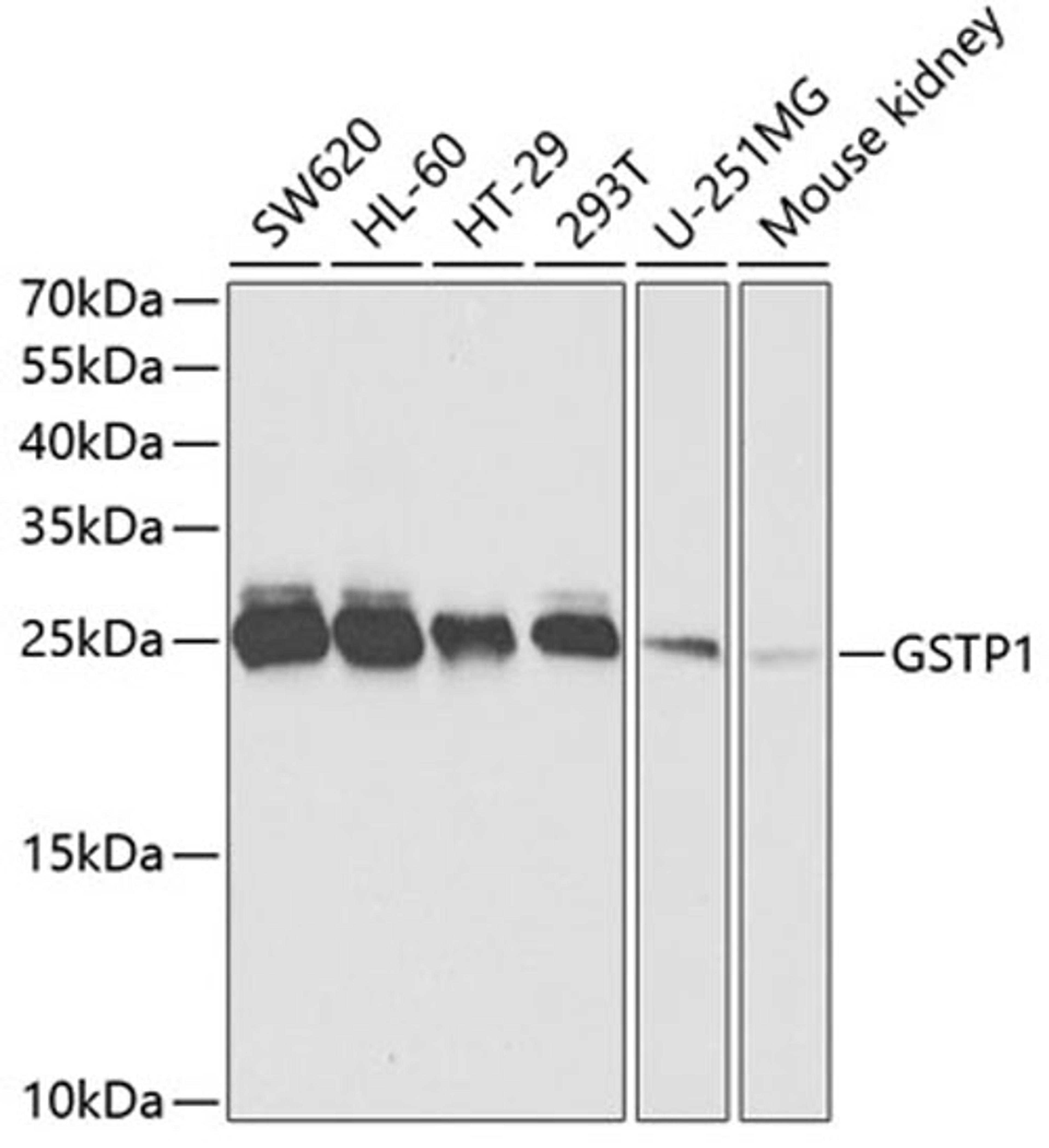 Western blot - GSTP1 antibody (A5691)