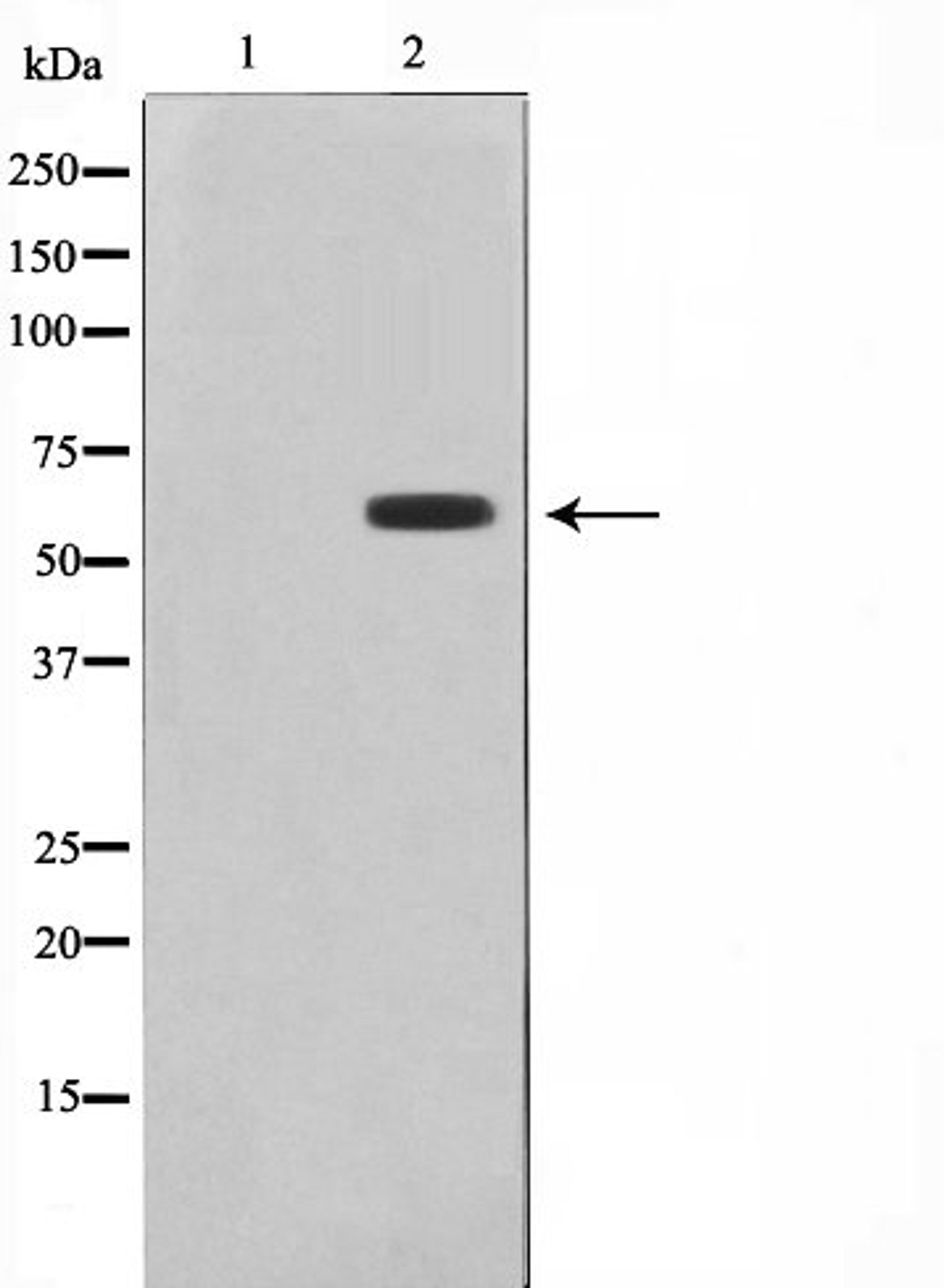 Western blot analysis of HepG2 cell lysate using 26A1 (Cytochrome P450) antibody