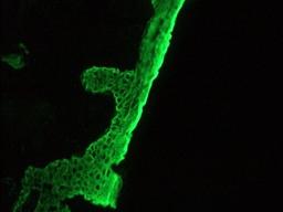 Immunohistochemistry-Frozen: Basal cell cytokeratin Antibody (RCK103) [NBP1-97729] - Frozen sections of human skin