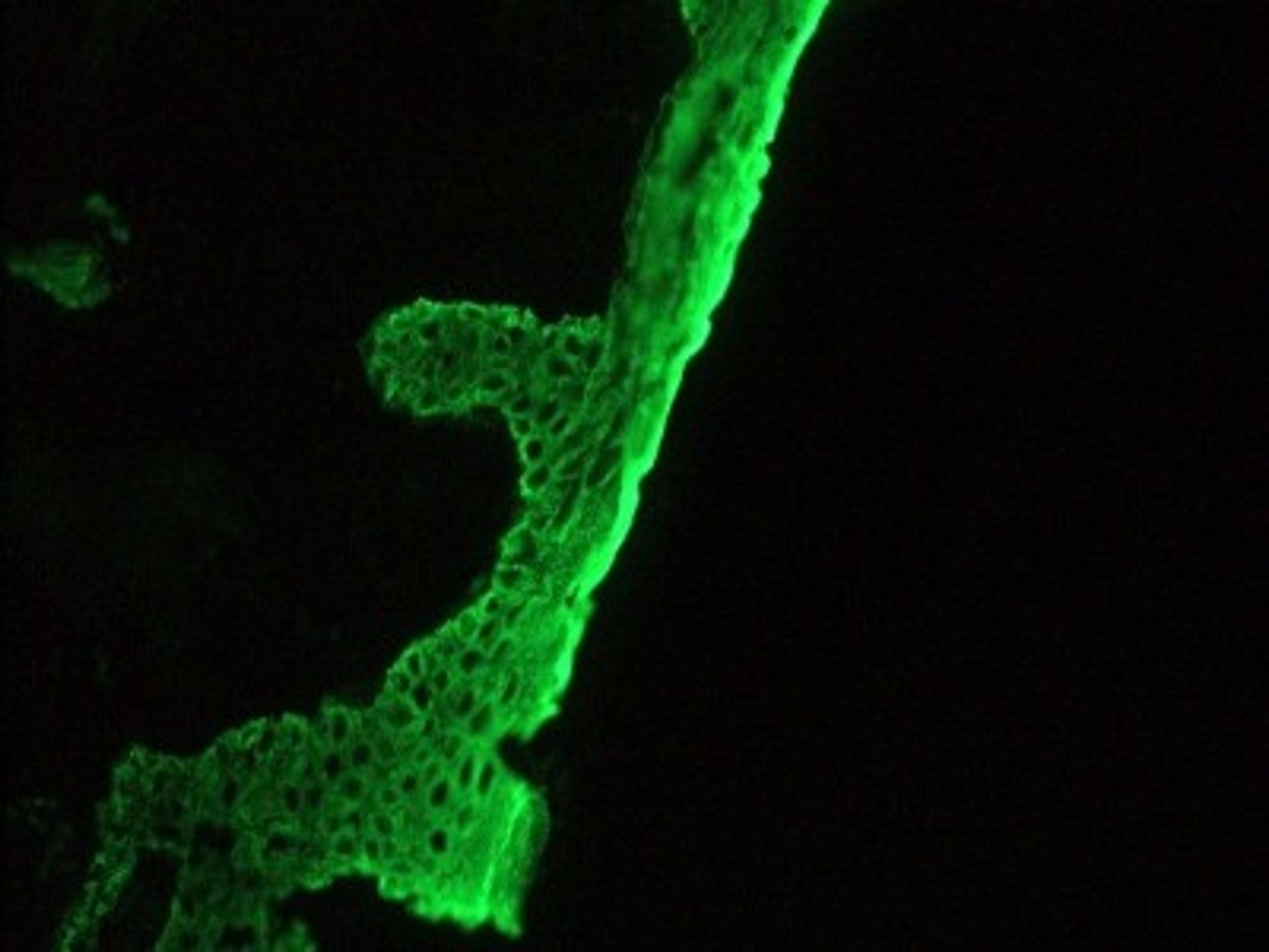 Immunohistochemistry-Frozen: Basal cell cytokeratin Antibody (RCK103) [NBP1-97729] - Frozen sections of human skin