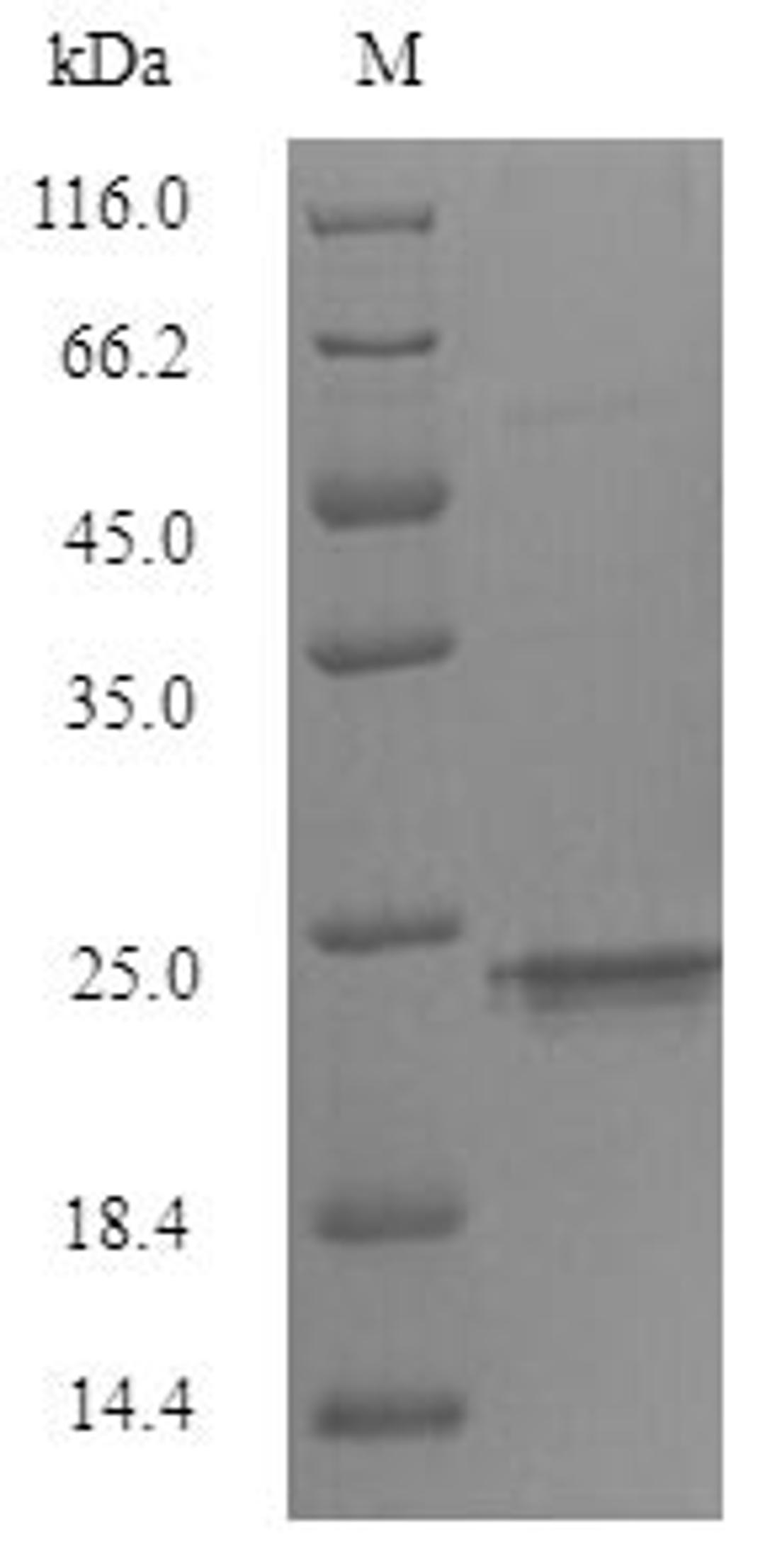 (Tris-Glycine gel) Discontinuous SDS-PAGE (reduced) with 5% enrichment gel and 15% separation gel.