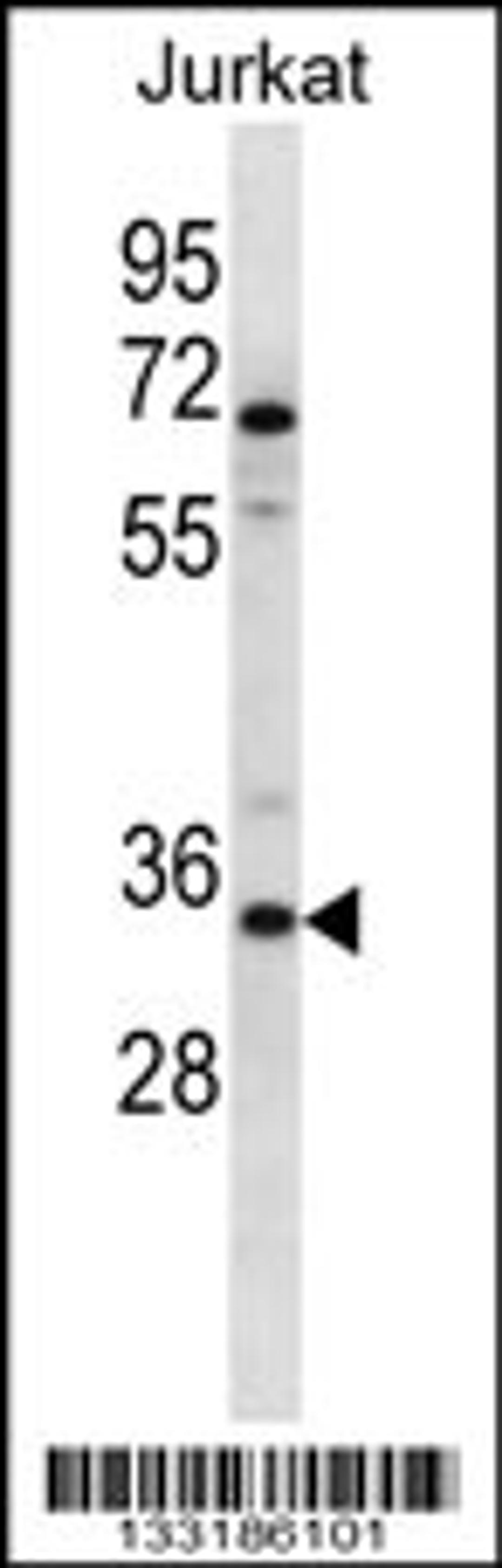 Western blot analysis in Jurkat cell line lysates (35ug/lane).