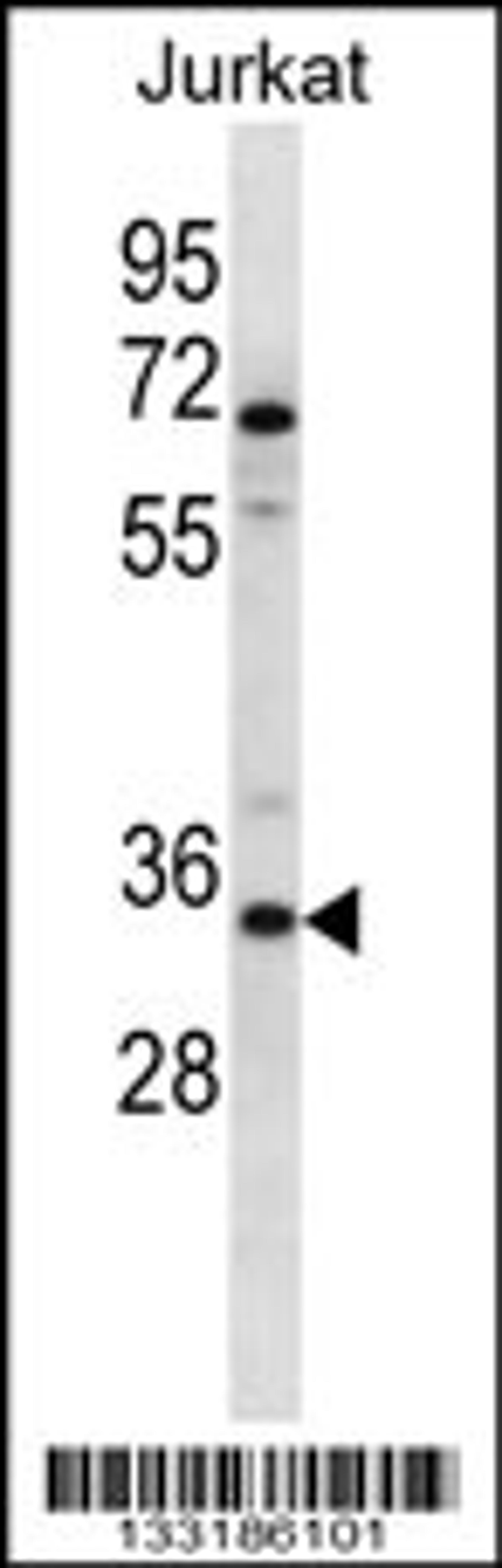 Western blot analysis in Jurkat cell line lysates (35ug/lane).