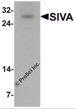 Western blot analysis of SIVA in mouse liver tissue lysate with SIVA antibody at 1 μg/mL.