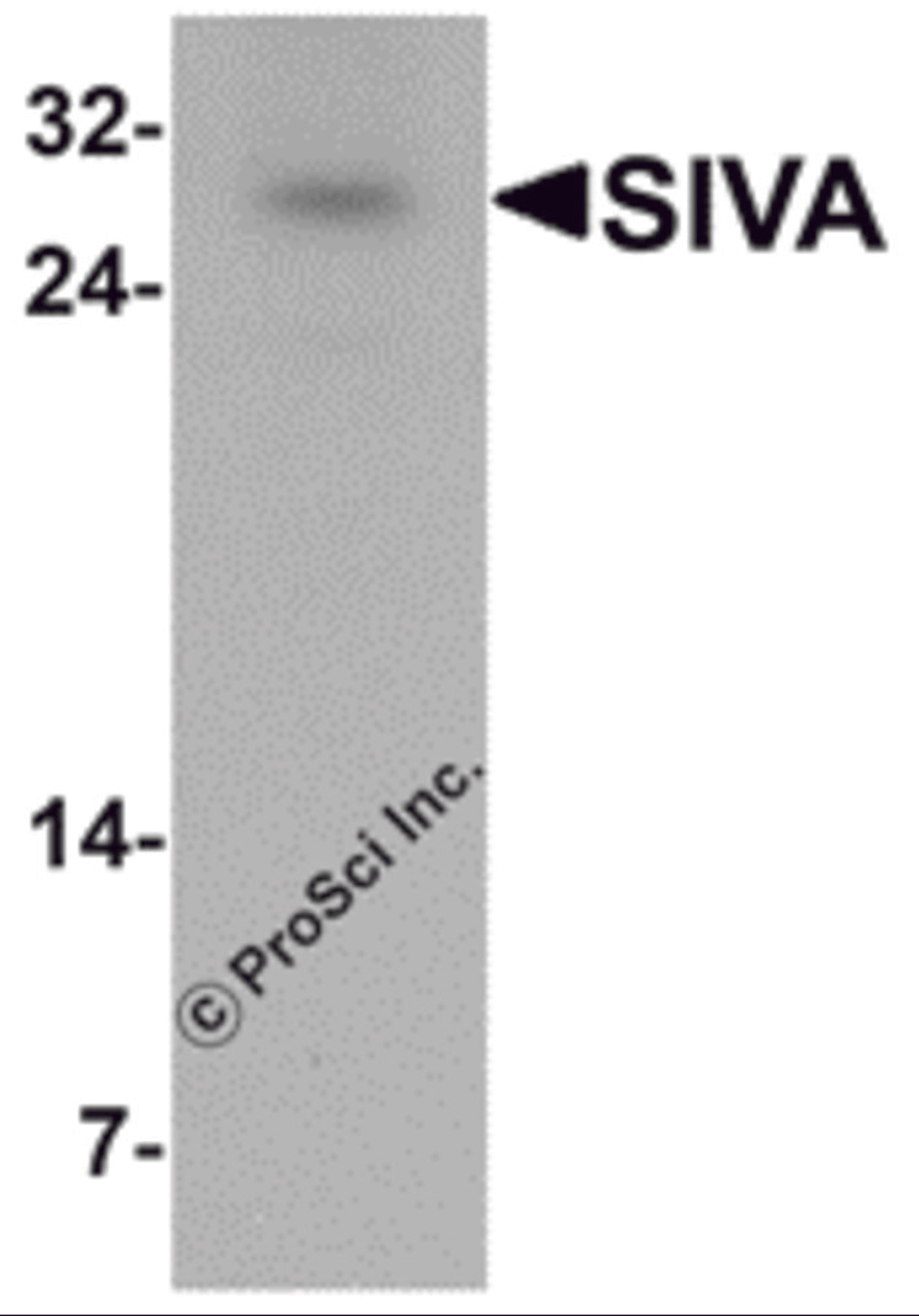Western blot analysis of SIVA in mouse liver tissue lysate with SIVA antibody at 1 μg/mL.