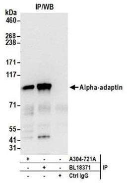 Detection of human Alpha-adaptin by western blot of immunoprecipitates.