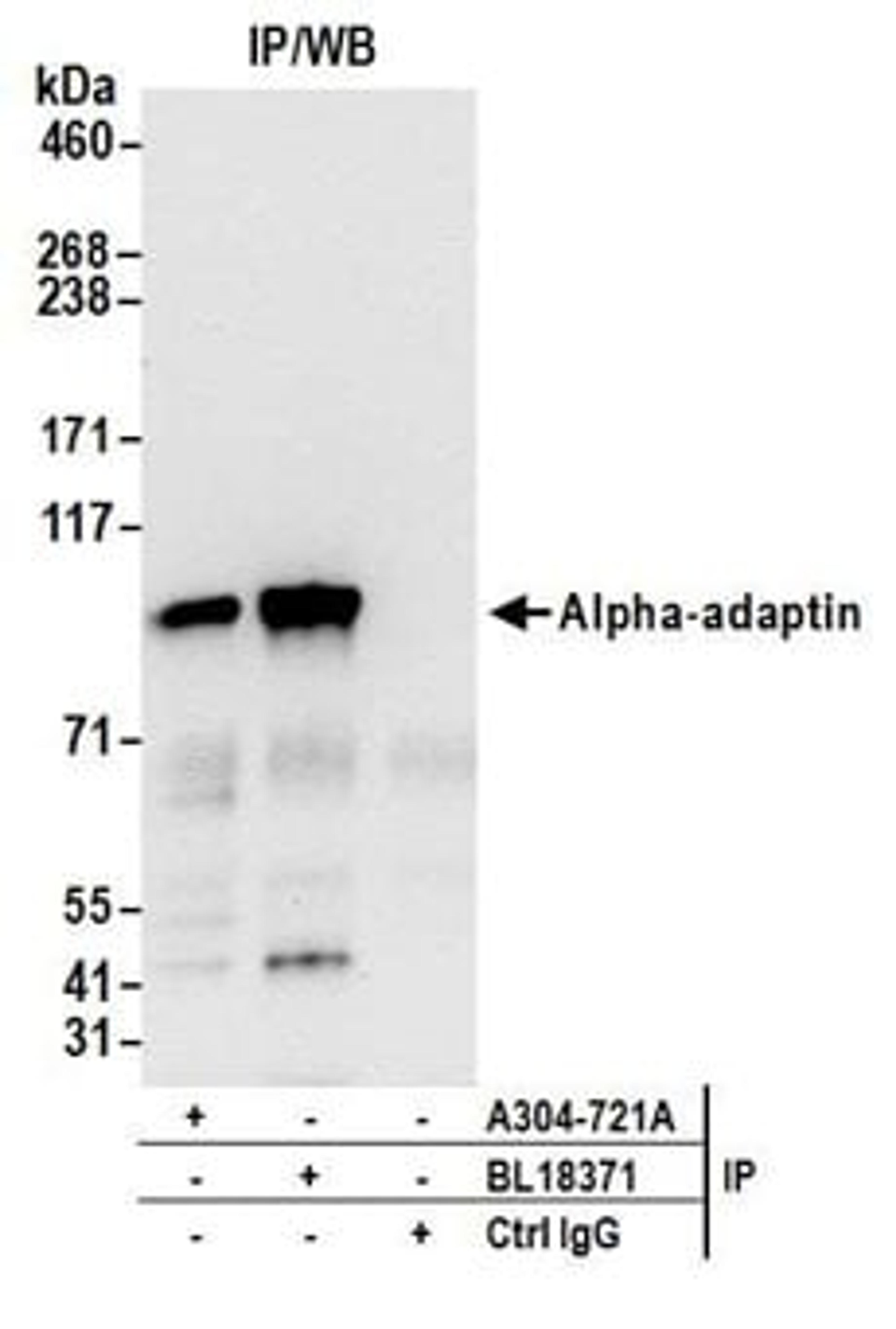 Detection of human Alpha-adaptin by western blot of immunoprecipitates.