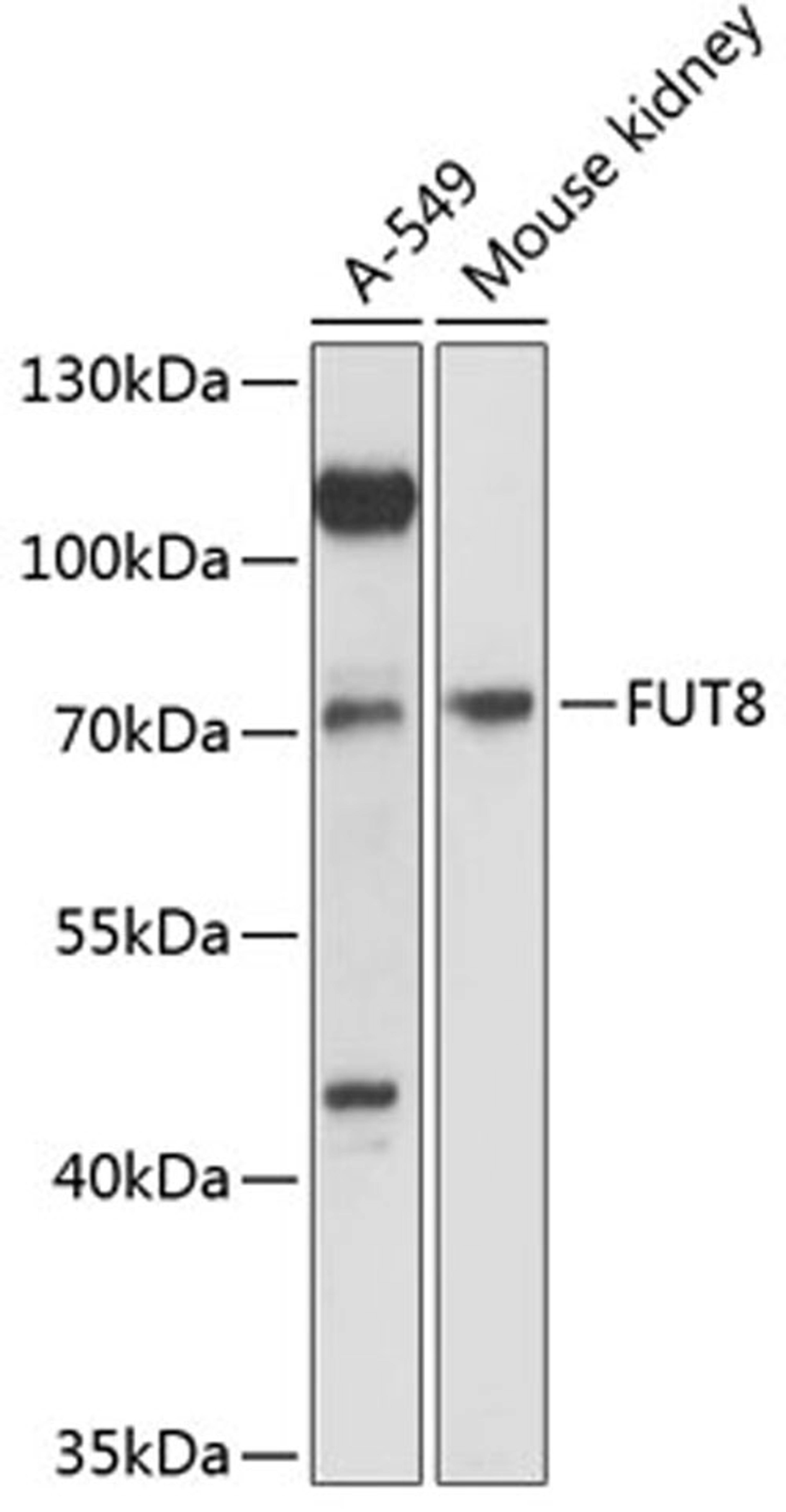 Western blot - FUT8 antibody (A12933)