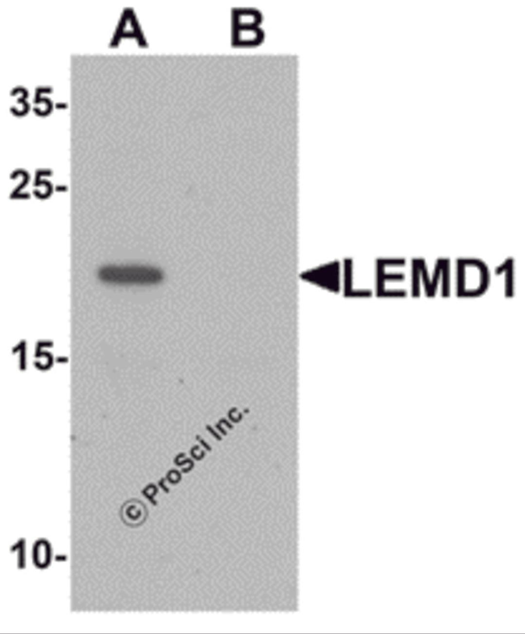 Western blot analysis of LEMD1 in A20 cell lysate with LEMD1 antibody at 1 &#956;g/mL in (A) the absence and (B) the presence of blocking peptide.