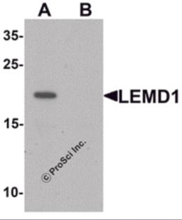 Western blot analysis of LEMD1 in A20 cell lysate with LEMD1 antibody at 1 &#956;g/mL in (A) the absence and (B) the presence of blocking peptide.