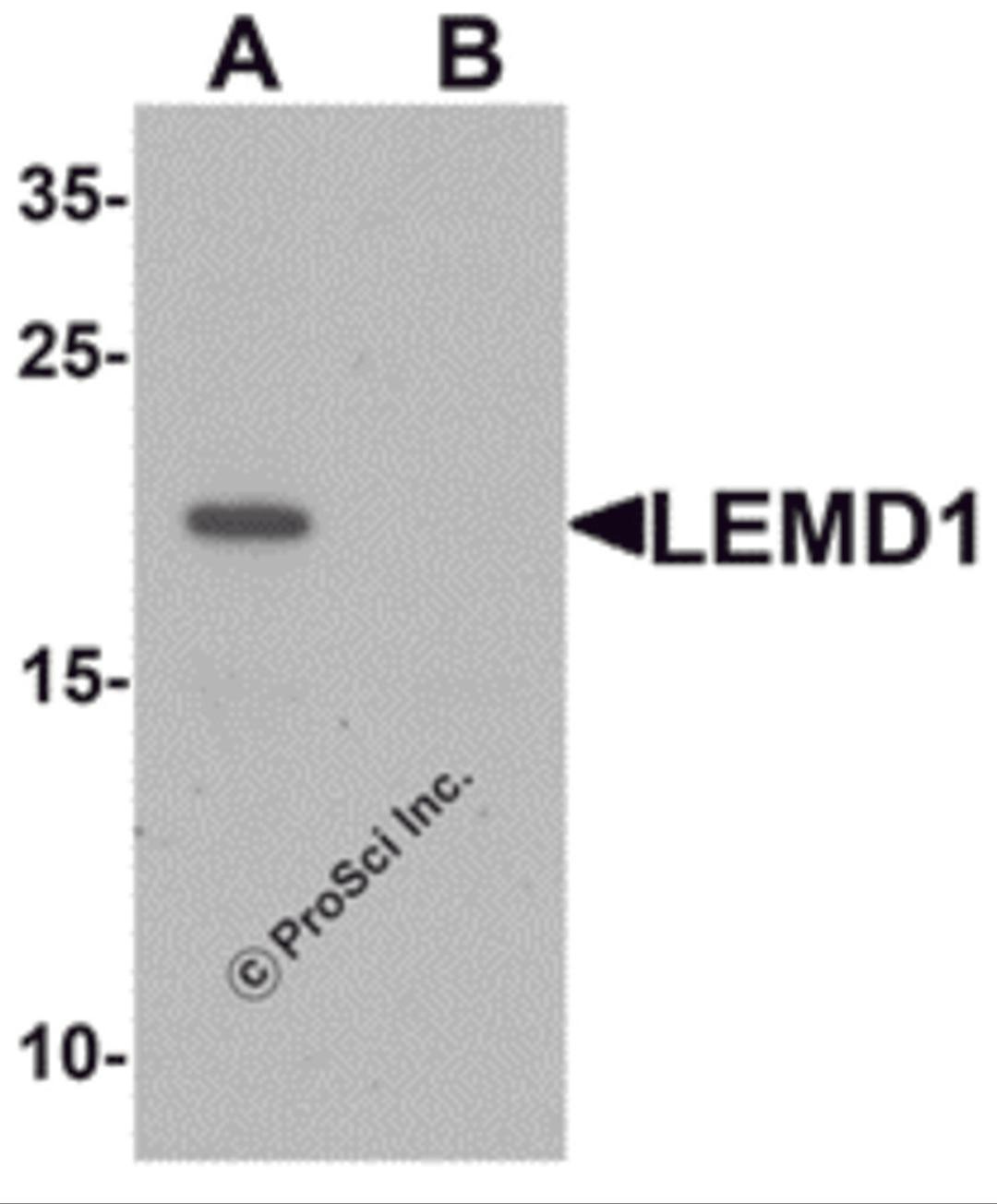 Western blot analysis of LEMD1 in A20 cell lysate with LEMD1 antibody at 1 μg/mL in (A) the absence and (B) the presence of blocking peptide.