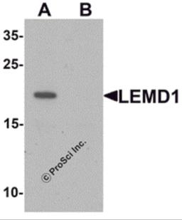 Western blot analysis of LEMD1 in A20 cell lysate with LEMD1 antibody at 1 μg/mL in (A) the absence and (B) the presence of blocking peptide.