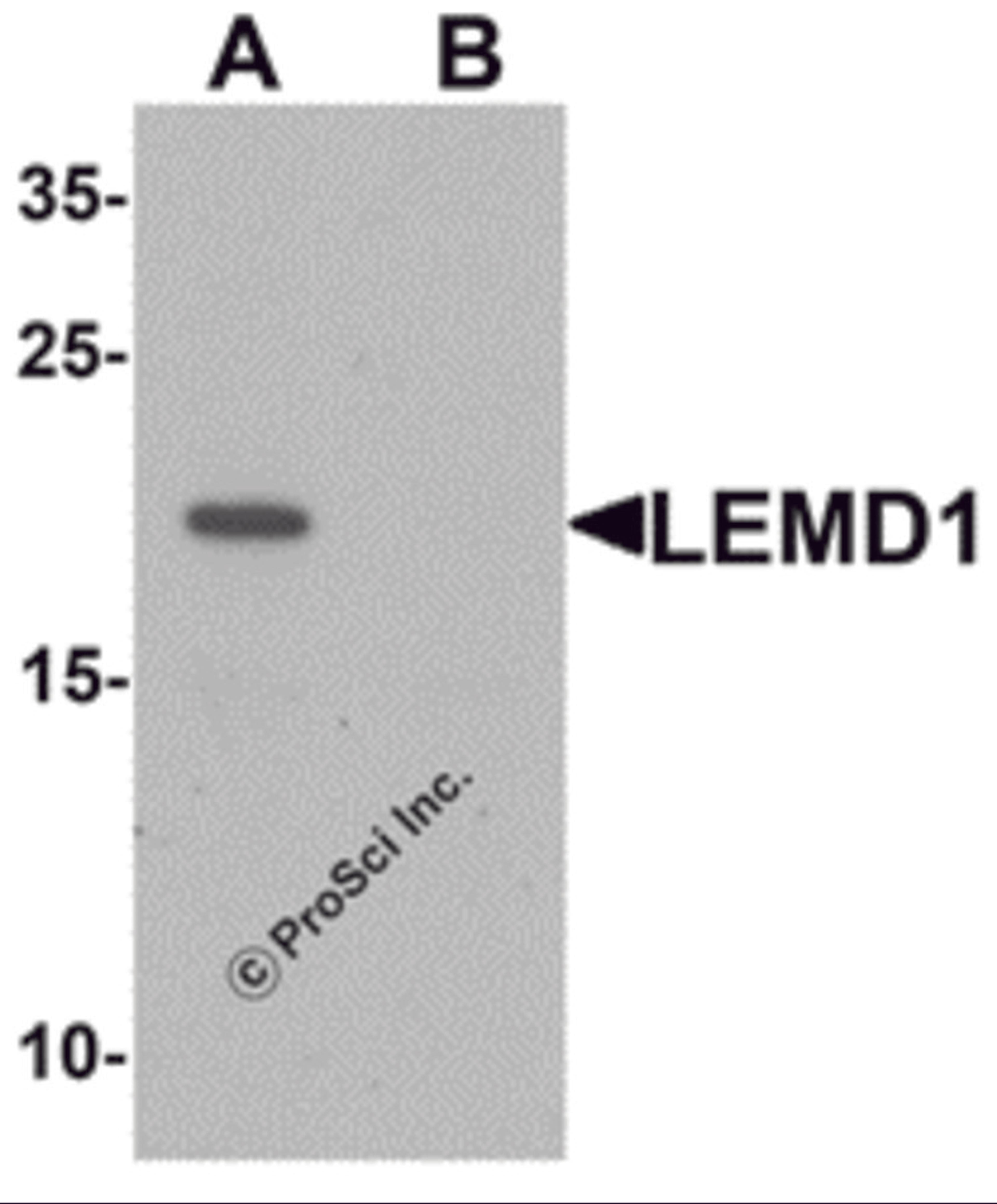 Western blot analysis of LEMD1 in A20 cell lysate with LEMD1 antibody at 1 μg/mL in (A) the absence and (B) the presence of blocking peptide.